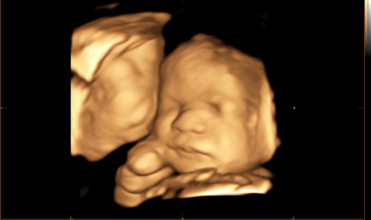 8K Ultrasound Image