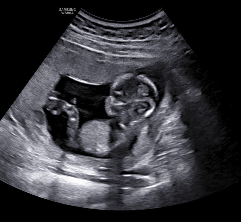 2D Ultrasound Franklin, TN