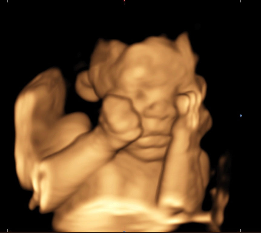 Hendersonville 3D 4D ultrasound Franklin, TN